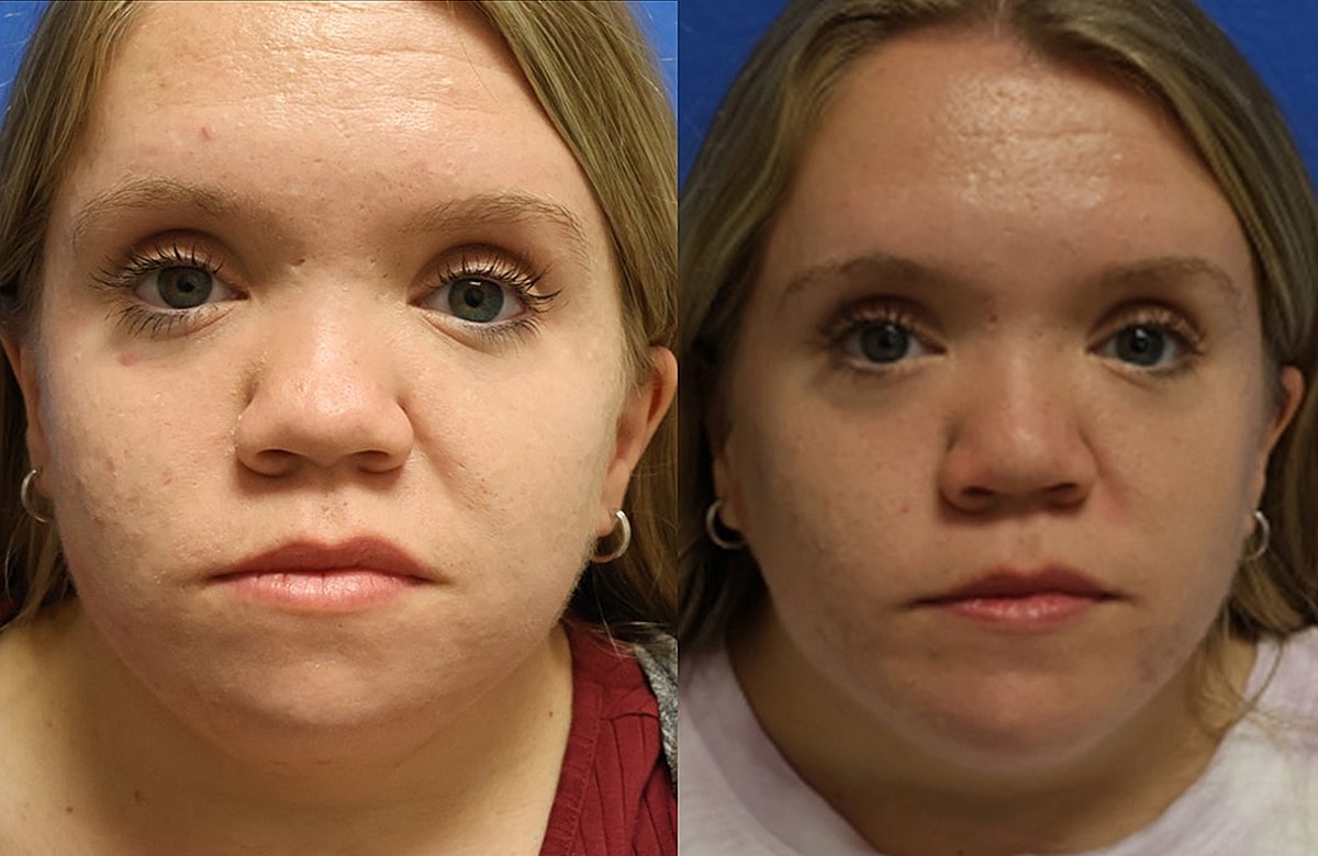 Before & After