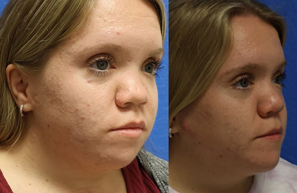 Before & After