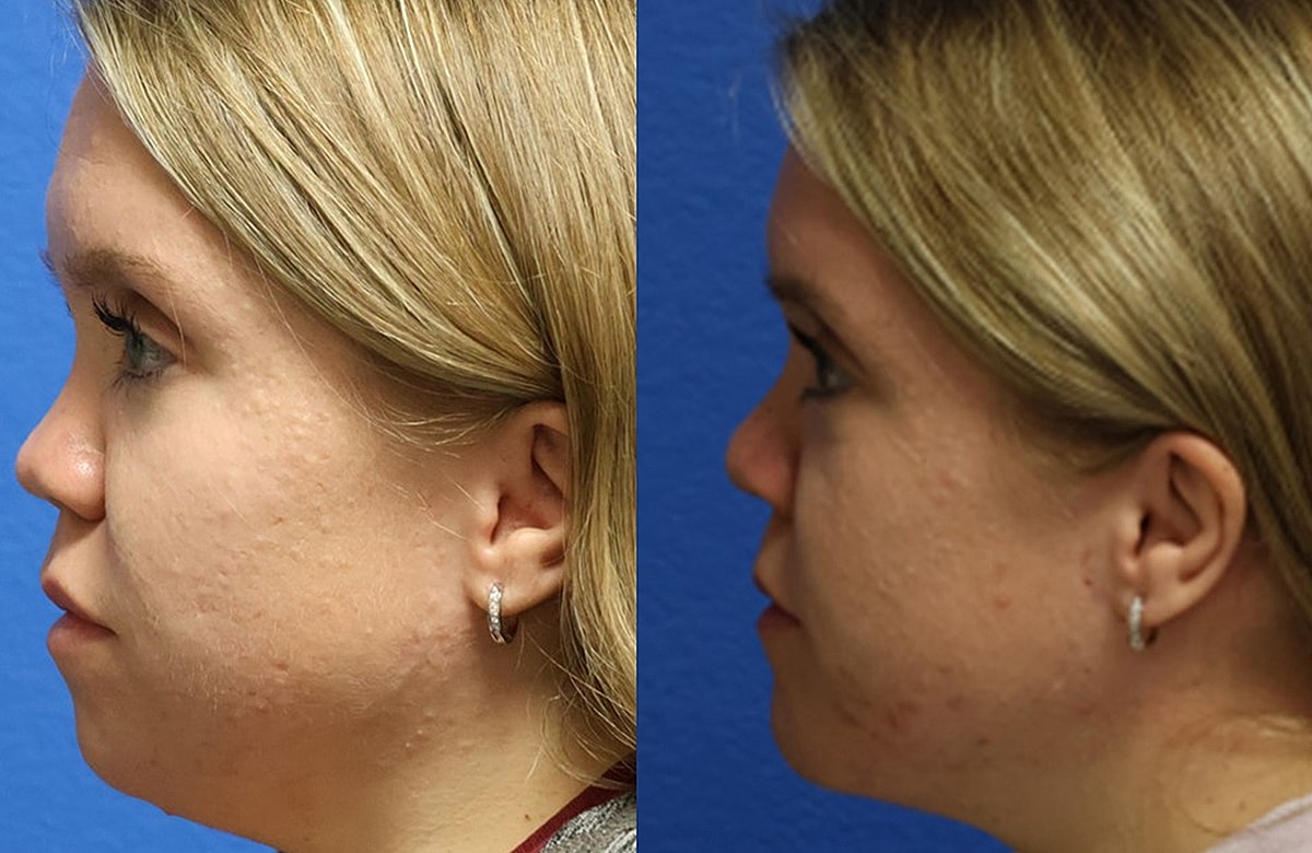 Before & After