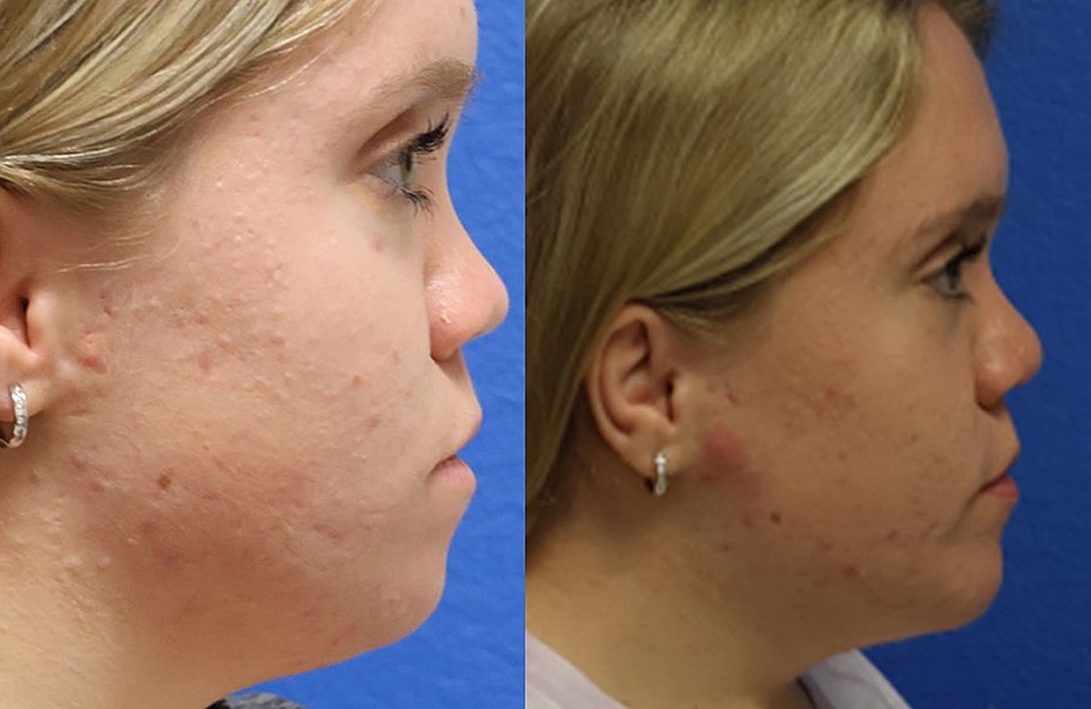 Before & After